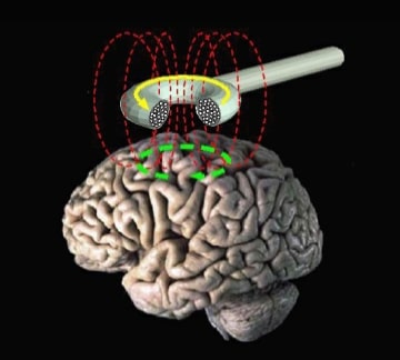 Wassermann, Eric. Transcranial Brain Stimulation. Behavioral Neurology Unit. National Institute of Neurological Disorders and Stroke